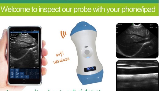 micro-convex/linear dual-head wireless probe type color doppler ultrasound scanner